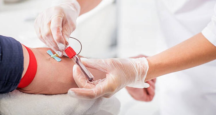 pentingnya tes darah lengkap dalam menjaga kesehatan