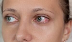 tips meningkatkan kesehatan mata - cara ampuh merawat mata agar tetap sehat dari penyakit mata