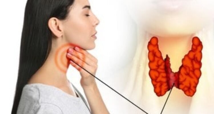 penyebab dan gejala gangguan kelenjar tiroid