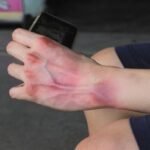 tips menghindari kerusakan pada tangan akibat penggunaan gadget yang berlebihan